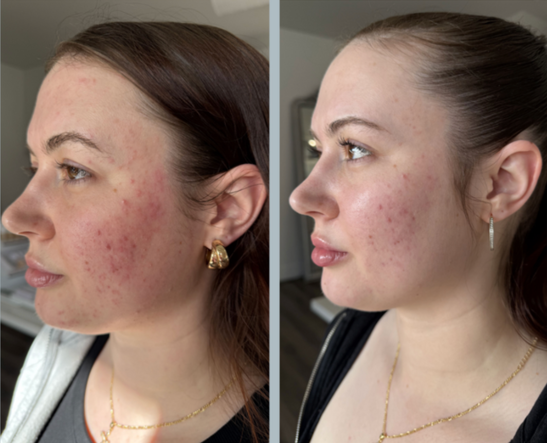 REGEN PDRN+ Serum
